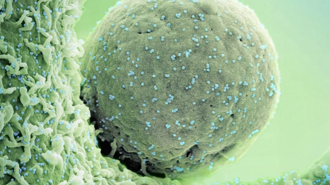 Novel Coronavirus SARS-CoV-2 (Omicron) Colorized scanning electron micrograph of a cell (green) infected with the Omicron strain of SARS-CoV-2 virus particles (blue), isolated from a patient sample. Image captured at the NIAID Integrated Research Facility (IRF) in Fort Detrick, Maryland. Credit: NIAID https://www.flickr.com/photos/niaid/53428060492/